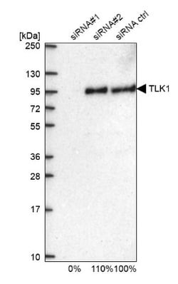 TLK1 Antibody, Novus Biologicals 25 &mu;L; Unlabeled:Antibodies, Polyclonal